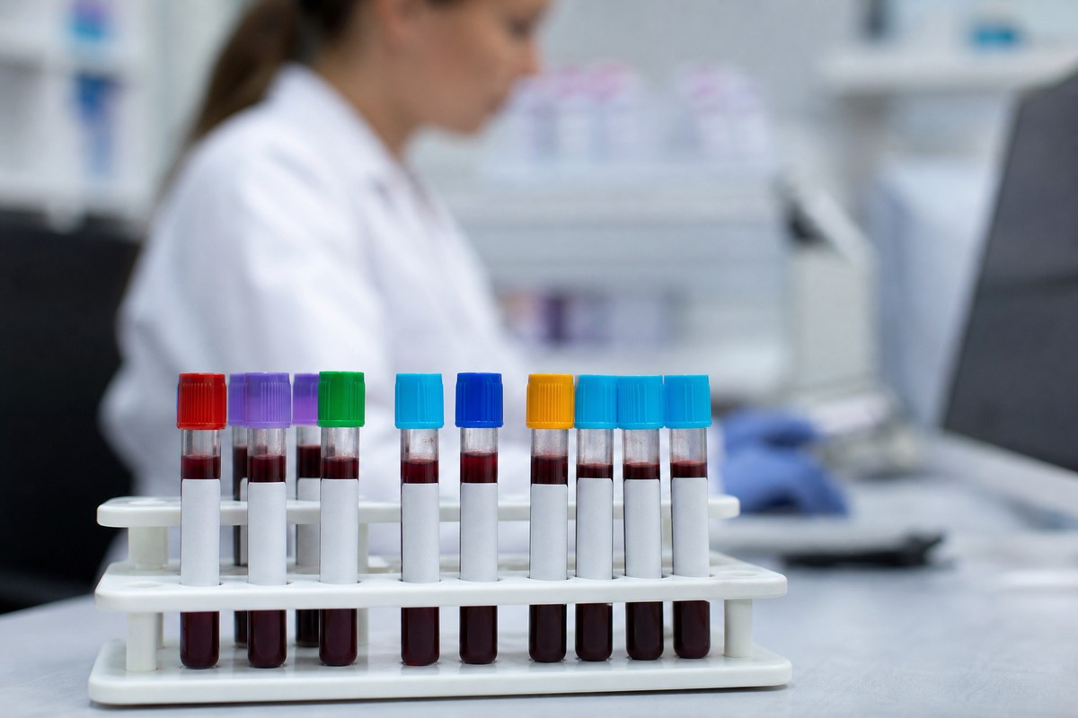 Labeled blood sample tubes in a laboratory rack used to investigate causes of chronic fatigue