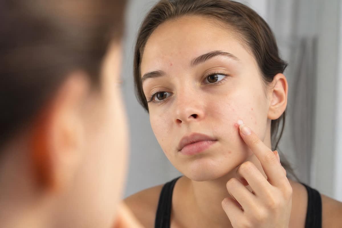 Young person applying a small dot of spot treatment cream to a blemish on the cheek in front of a mirror